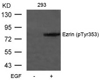 Anti-Phospho-Ezrin (Tyr353) Rabbit Polyclonal Antibody