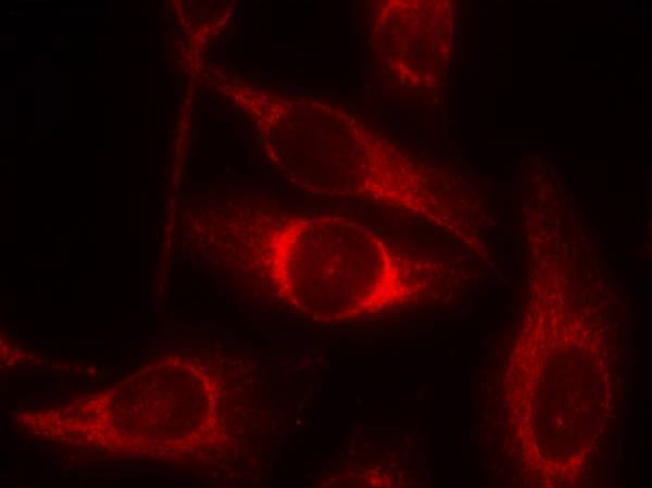 Anti-Phospho-p53 (Ser46) Rabbit Polyclonal Antibody