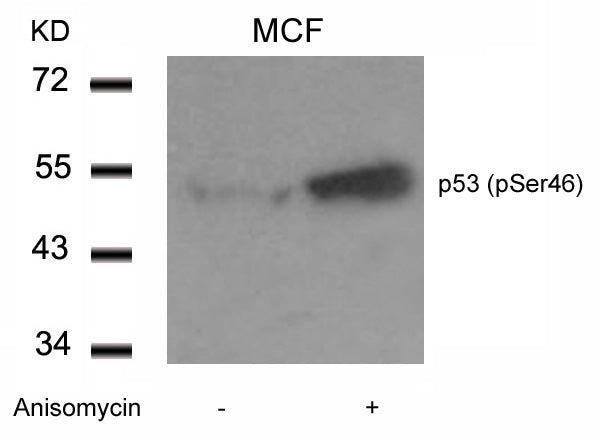 Anti-Phospho-p53 (Ser46) Rabbit Polyclonal Antibody