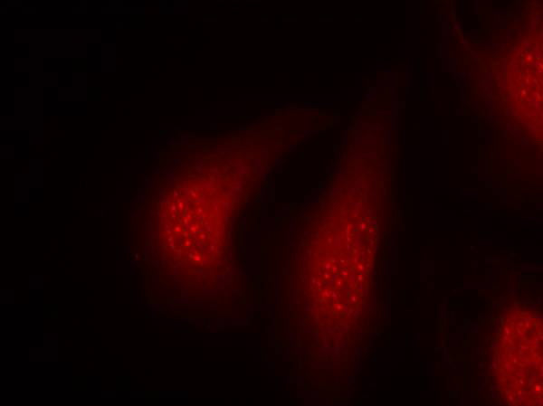 Anti-Phospho-RSK1 p90 (Thr348) Rabbit Polyclonal Antibody