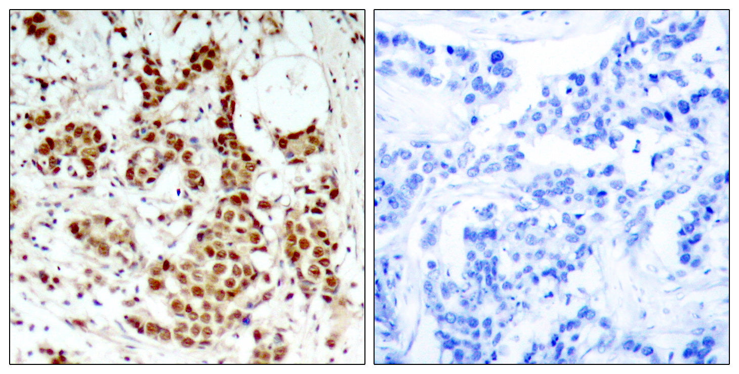 Anti-Phospho-RSK1 p90 (Thr348) Rabbit Polyclonal Antibody