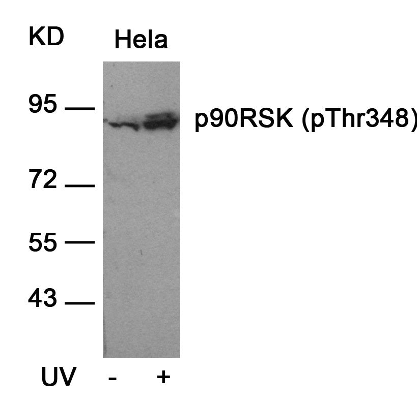 Anti-Phospho-RSK1 p90 (Thr348) Rabbit Polyclonal Antibody