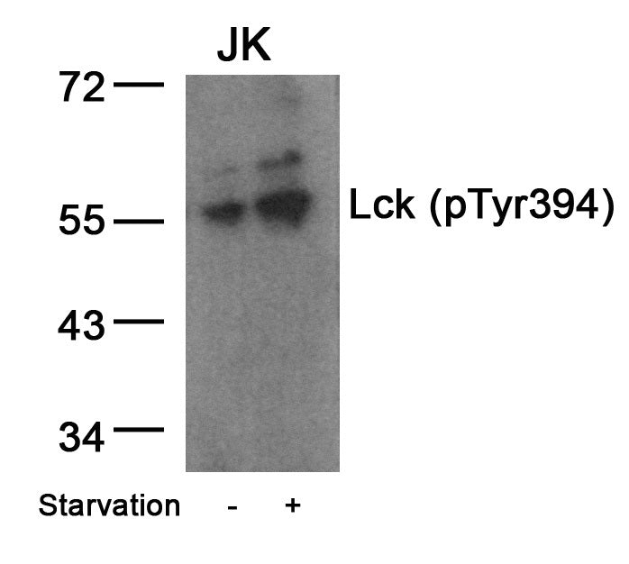 Anti-Phospho-Lck (Try394) Rabbit Polyclonal Antibody