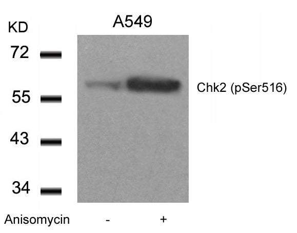 Anti-Phospho-Chk2 (Ser516) Rabbit Polyclonal Antibody