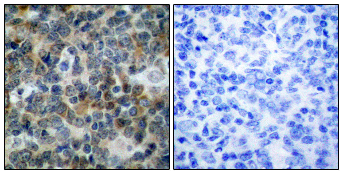 Anti-Phospho-VASP (Ser239) Rabbit Polyclonal Antibody