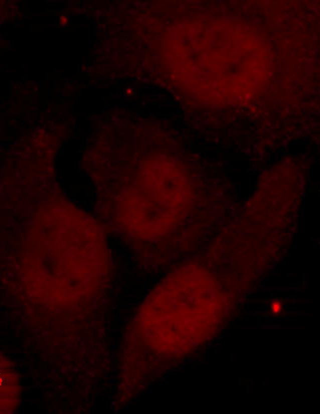 Anti-Phospho-HDAC2 (Ser394) Rabbit Polyclonal Antibody