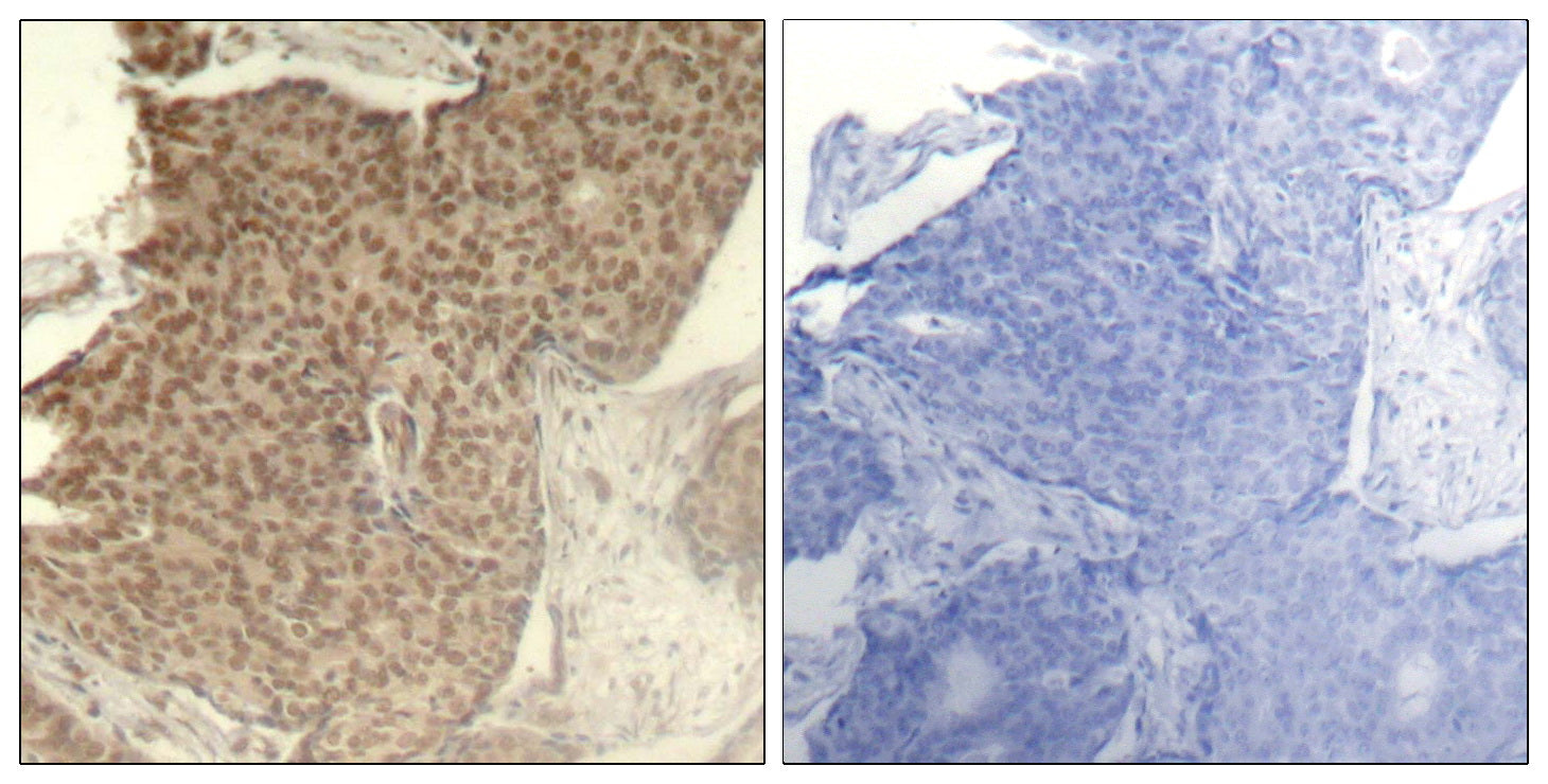 Anti-Phospho-HDAC2 (Ser394) Rabbit Polyclonal Antibody