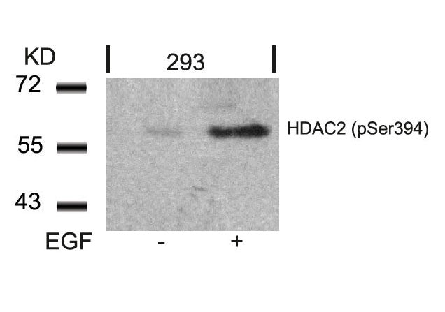 Anti-Phospho-HDAC2 (Ser394) Rabbit Polyclonal Antibody