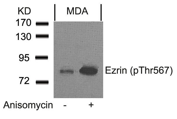 Anti-Phospho-Ezrin (Thr567) Rabbit Polyclonal Antibody