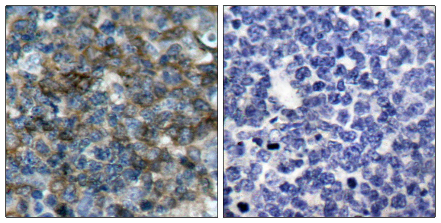 Anti-Phospho-VASP (Ser157) Rabbit Polyclonal Antibody