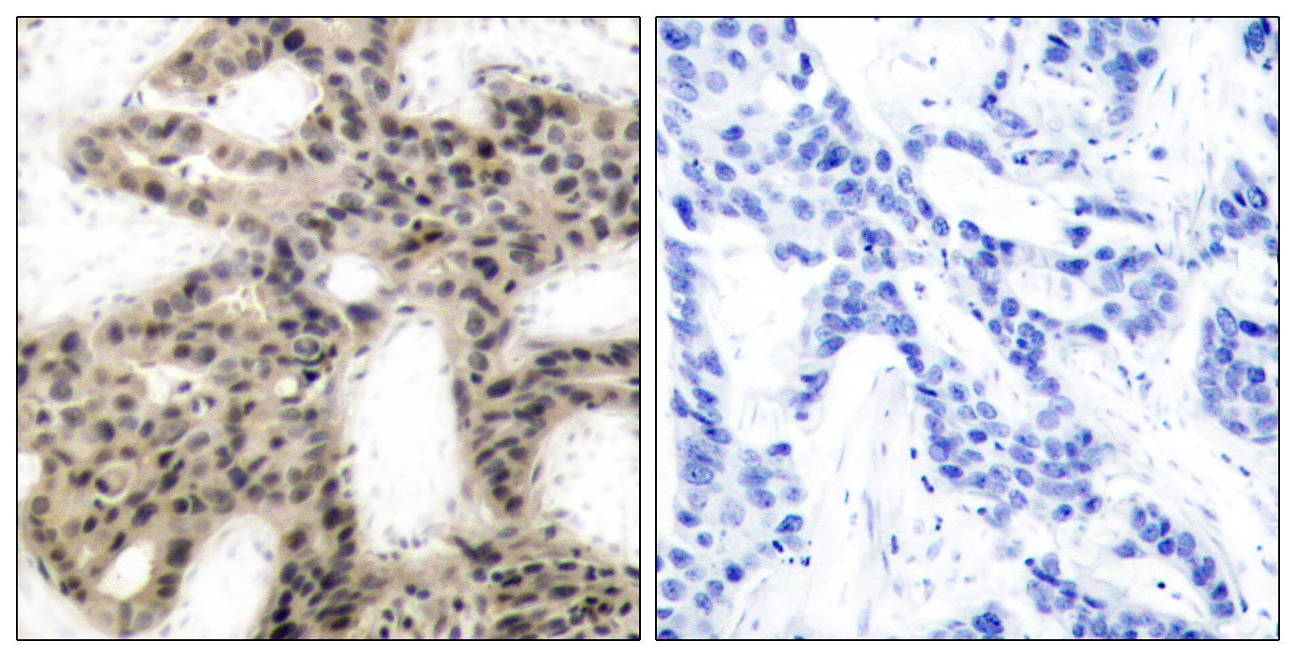 Anti-Phospho-4E BP1 (Thr46) Rabbit Polyclonal Antibody