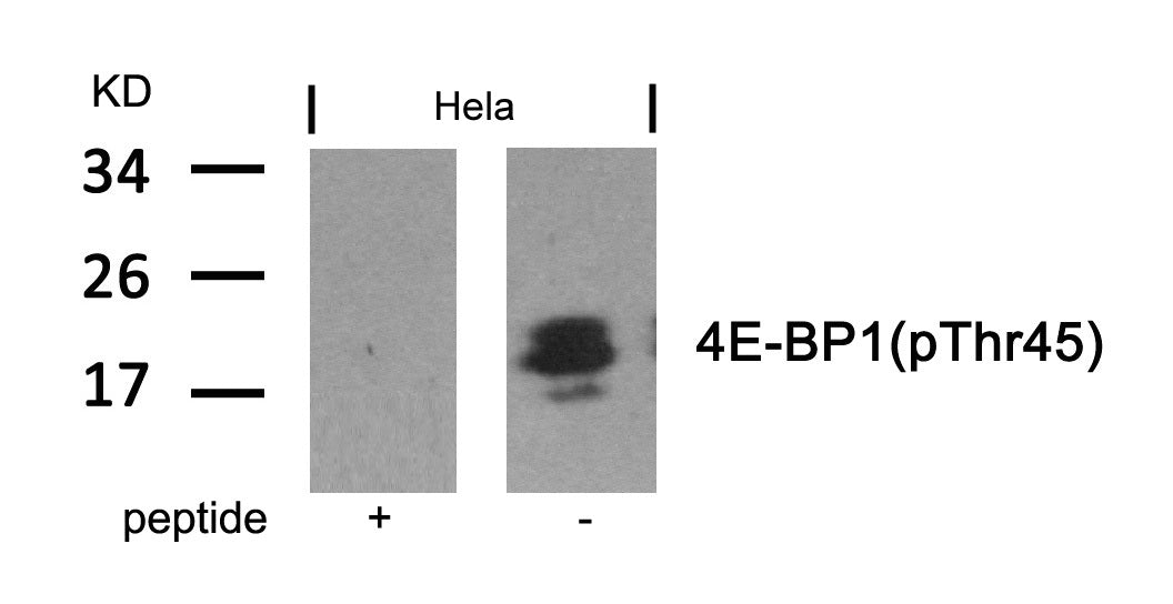 Anti-Phospho-4E BP1 (Thr46) Rabbit Polyclonal Antibody
