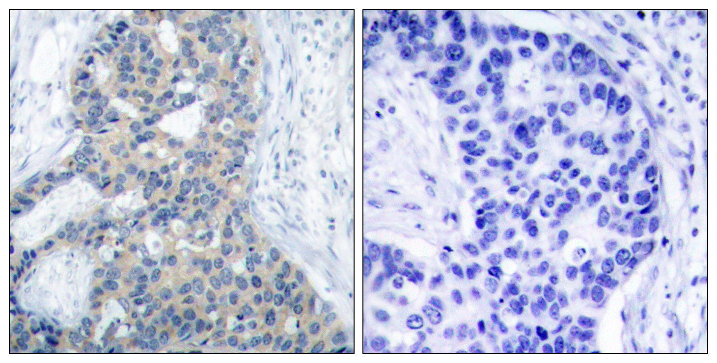 Anti-Phospho-Stathmin 1 (Ser38) Rabbit Polyclonal Antibody