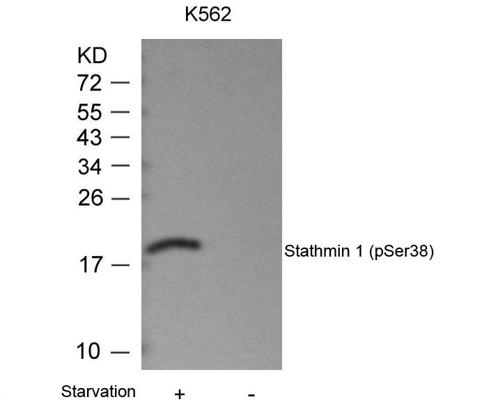 Anti-Phospho-Stathmin 1 (Ser38) Rabbit Polyclonal Antibody