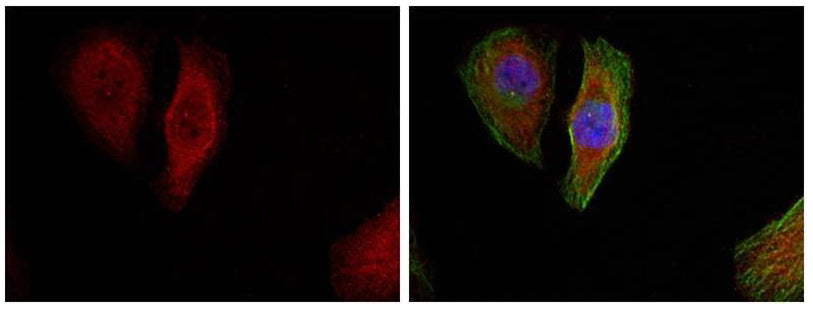 Anti-Phospho-ERK1/2 (Thr202/Thr185) Rabbit Polyclonal Antibody