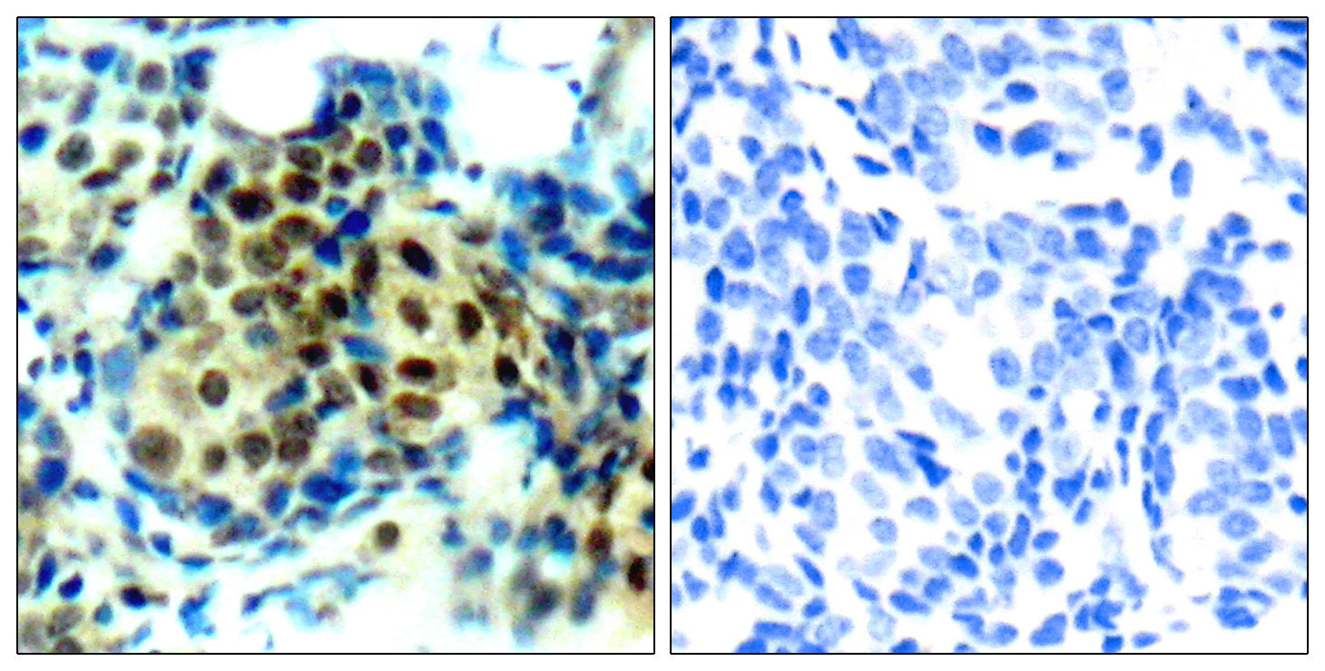 Anti-Phospho-ERK1/2 (Thr202/Thr185) Rabbit Polyclonal Antibody