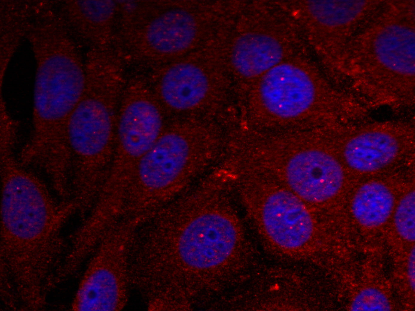 Anti-Phospho-alpha Synuclein (Tyr136) Rabbit Polyclonal Antibody