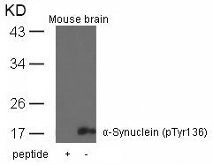 Anti-Phospho-alpha Synuclein (Tyr136) Rabbit Polyclonal Antibody