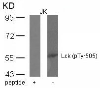 Anti-Phospho-Lck (Try505) Rabbit Polyclonal Antibody