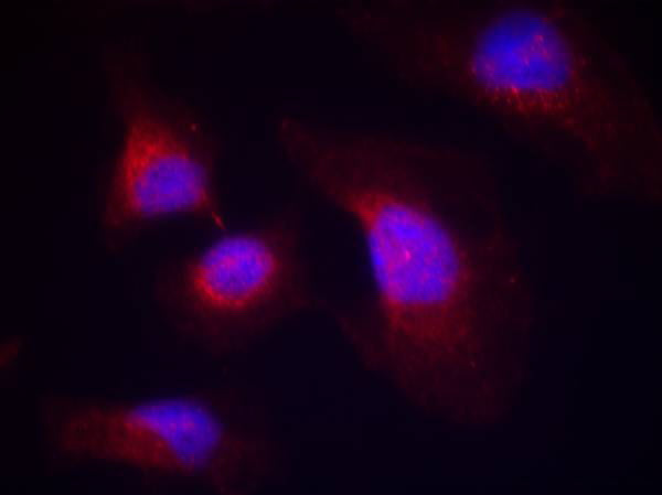 Anti-Phospho-Syk (Tyr323) Rabbit Polyclonal Antibody