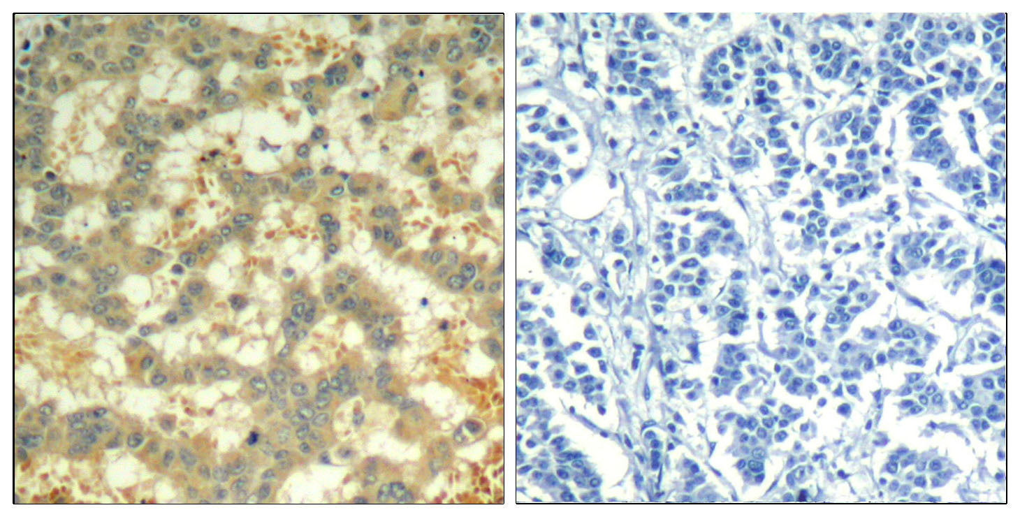 Anti-Phospho-Syk (Tyr323) Rabbit Polyclonal Antibody