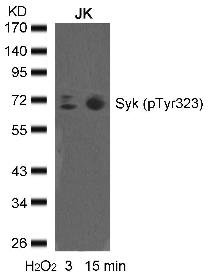 Anti-Phospho-Syk (Tyr323) Rabbit Polyclonal Antibody