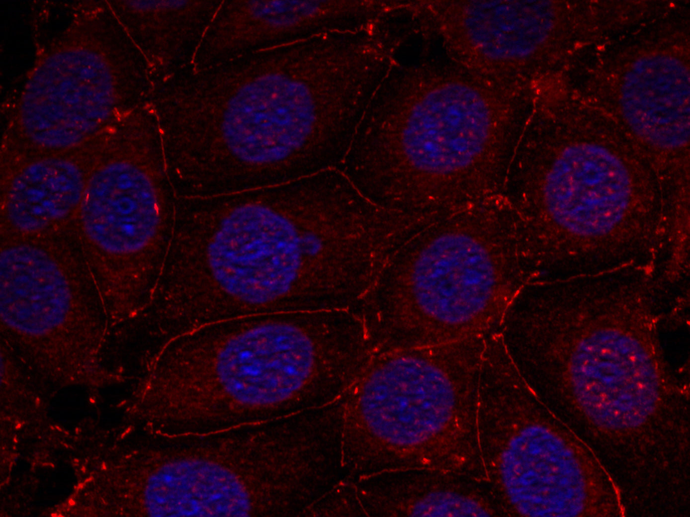 Anti-Phospho-IGF1 Receptor (Tyr1161) Rabbit Polyclonal Antibody