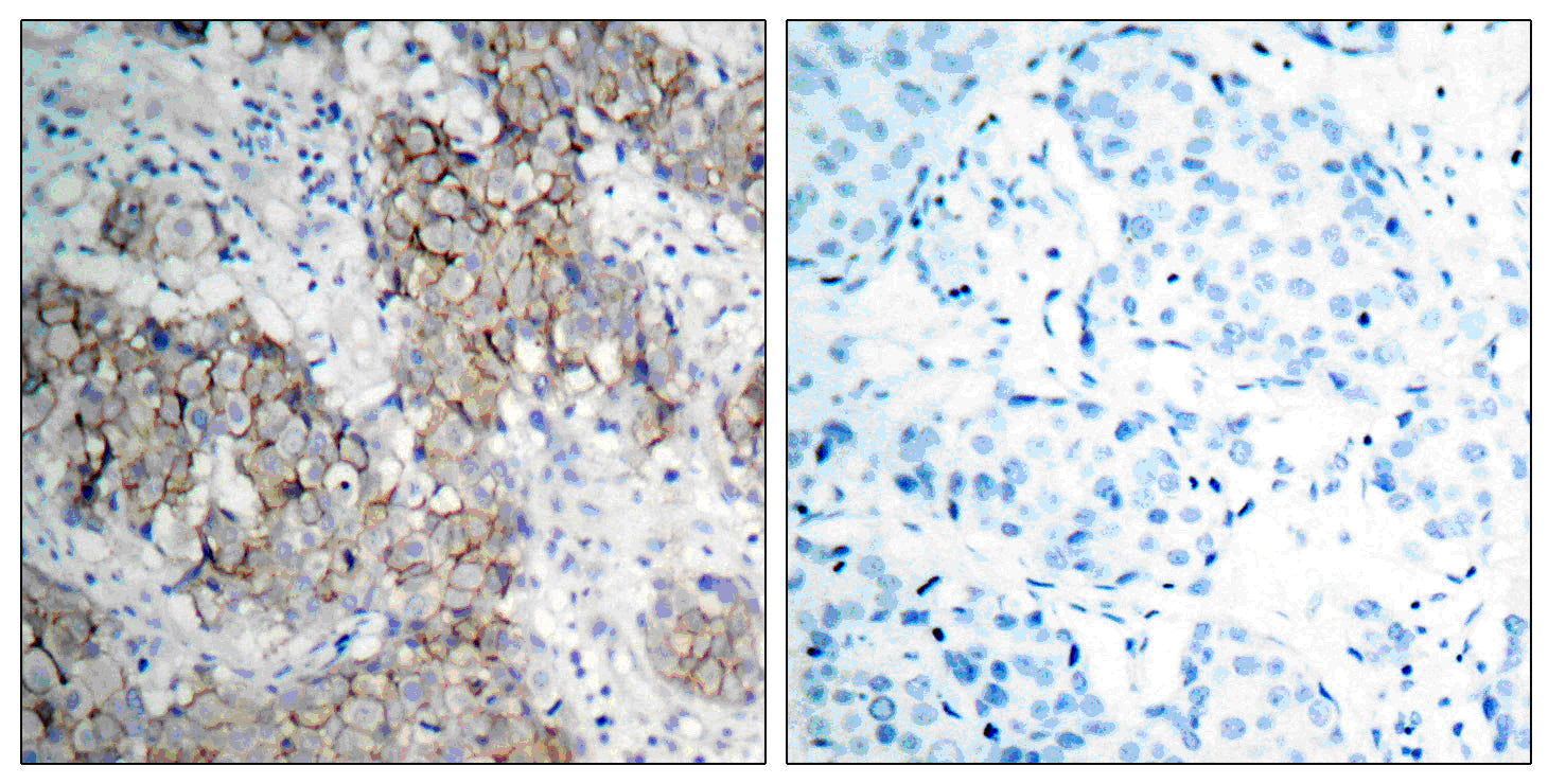 Anti-Phospho-IGF1 Receptor (Tyr1161) Rabbit Polyclonal Antibody