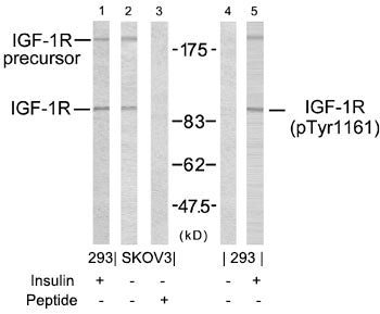Anti-Phospho-IGF1 Receptor (Tyr1161) Rabbit Polyclonal Antibody