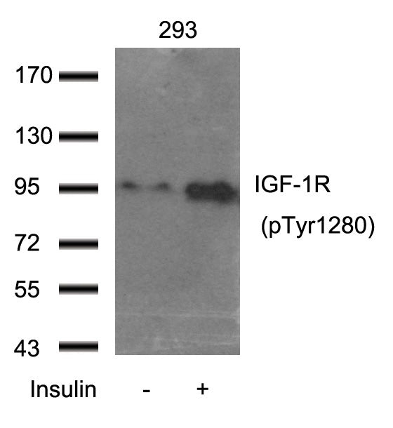 Anti-Phospho-IGF1 Receptor (Tyr1280) Rabbit Polyclonal Antibody