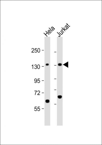 Anti-SF3B3 Rabbit Polyclonal Antibody