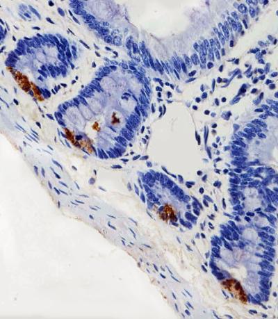 Anti-LYZ Rabbit Polyclonal Antibody