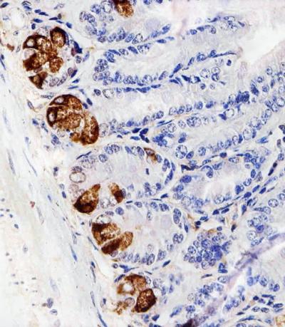 Anti-LYZ Rabbit Polyclonal Antibody