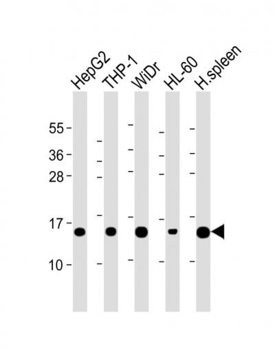 Anti-LYZ Rabbit Polyclonal Antibody