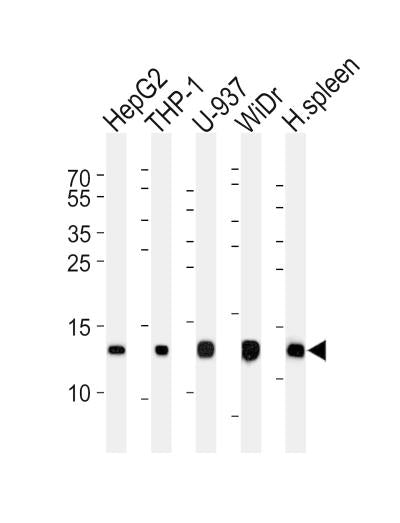 Anti-LYZ Rabbit Polyclonal Antibody