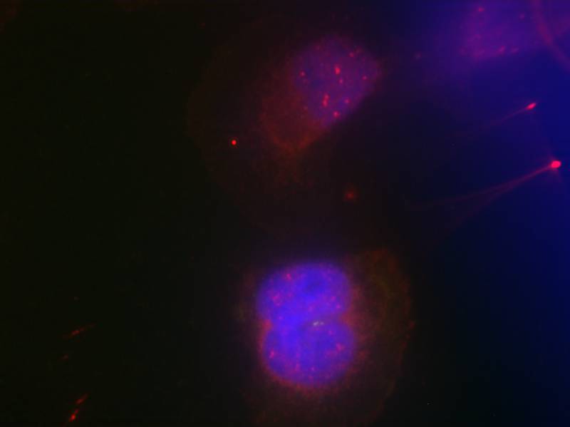 Anti-Phospho-BRCA1 (Ser988) Rabbit Polyclonal Antibody