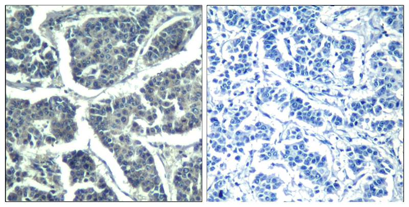 Anti-Phospho-PLCG2 (Tyr1217) Rabbit Polyclonal Antibody