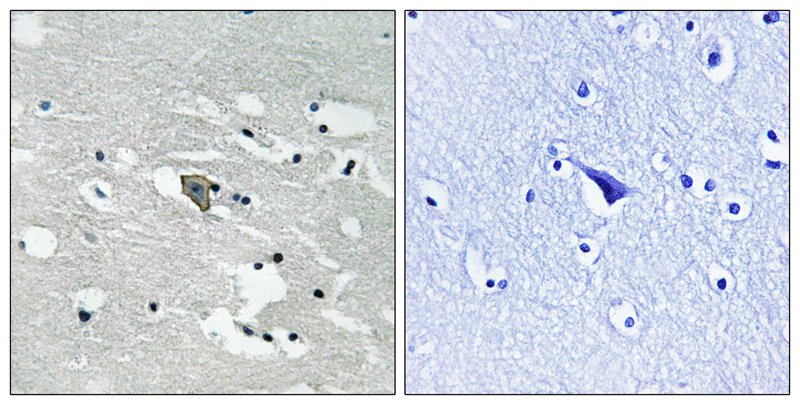Anti-Phospho-VEGF Receptor 1 (Tyr1048) Rabbit Polyclonal Antibody