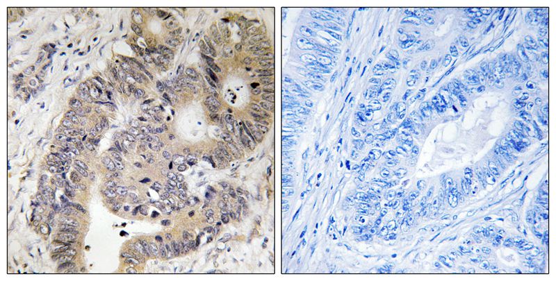 Anti-Phospho-CAD (Thr456) Rabbit Polyclonal Antibody