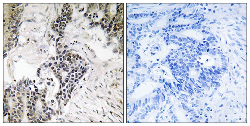 Anti-Phospho-CDC25C (Ser198) Rabbit Polyclonal Antibody