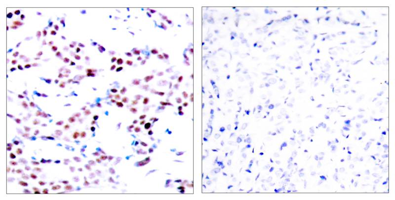 Anti-Phospho-c-Jun (Thr91) Rabbit Polyclonal Antibody