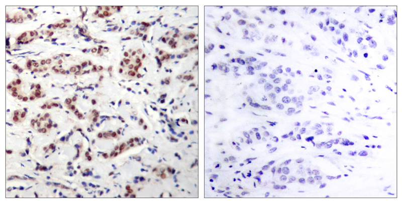 Anti-Phospho-STAT5a (Tyr694) Rabbit Polyclonal Antibody