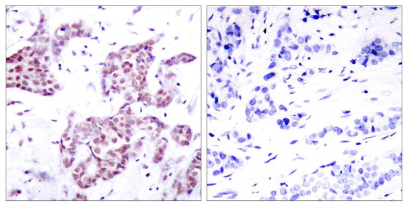 Anti-Phospho-STAT6 (Tyr641) Rabbit Polyclonal Antibody