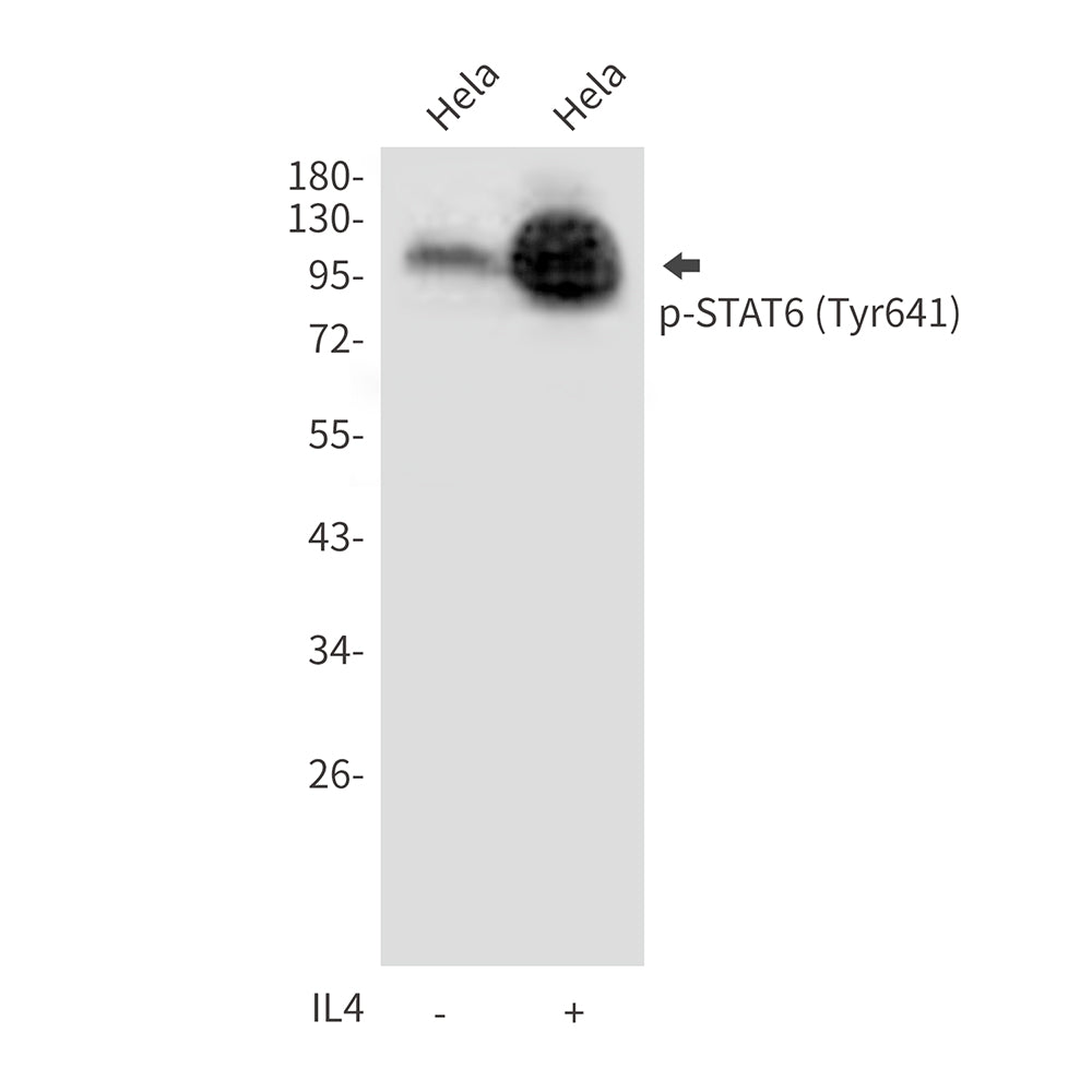 Anti-Phospho-STAT6 (Tyr641) Rabbit Polyclonal Antibody