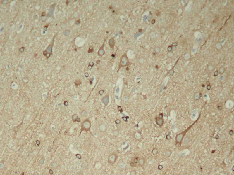Anti-Phospho-Tau (Ser396) Rabbit Polyclonal Antibody