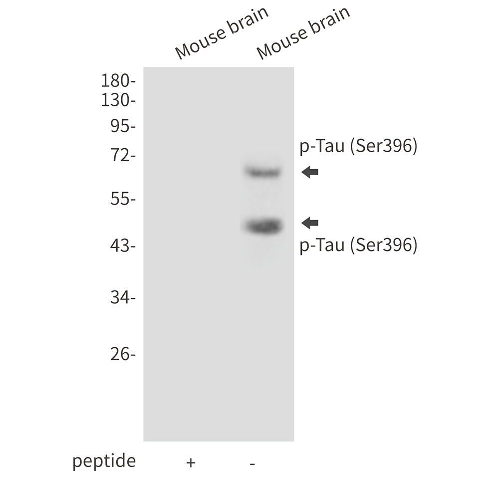 Anti-Phospho-Tau (Ser396) Rabbit Polyclonal Antibody