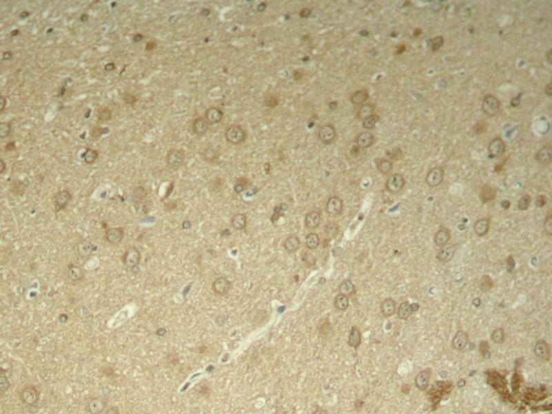 Anti-Phospho-Tau (Thr205) Rabbit Polyclonal Antibody