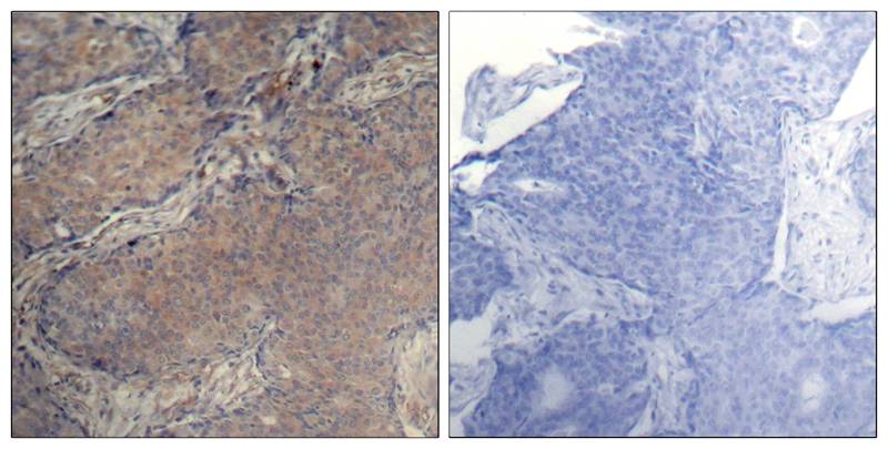 Anti-Phospho-Myosin Light Chain 2 (Ser19) Rabbit Polyclonal Antibody