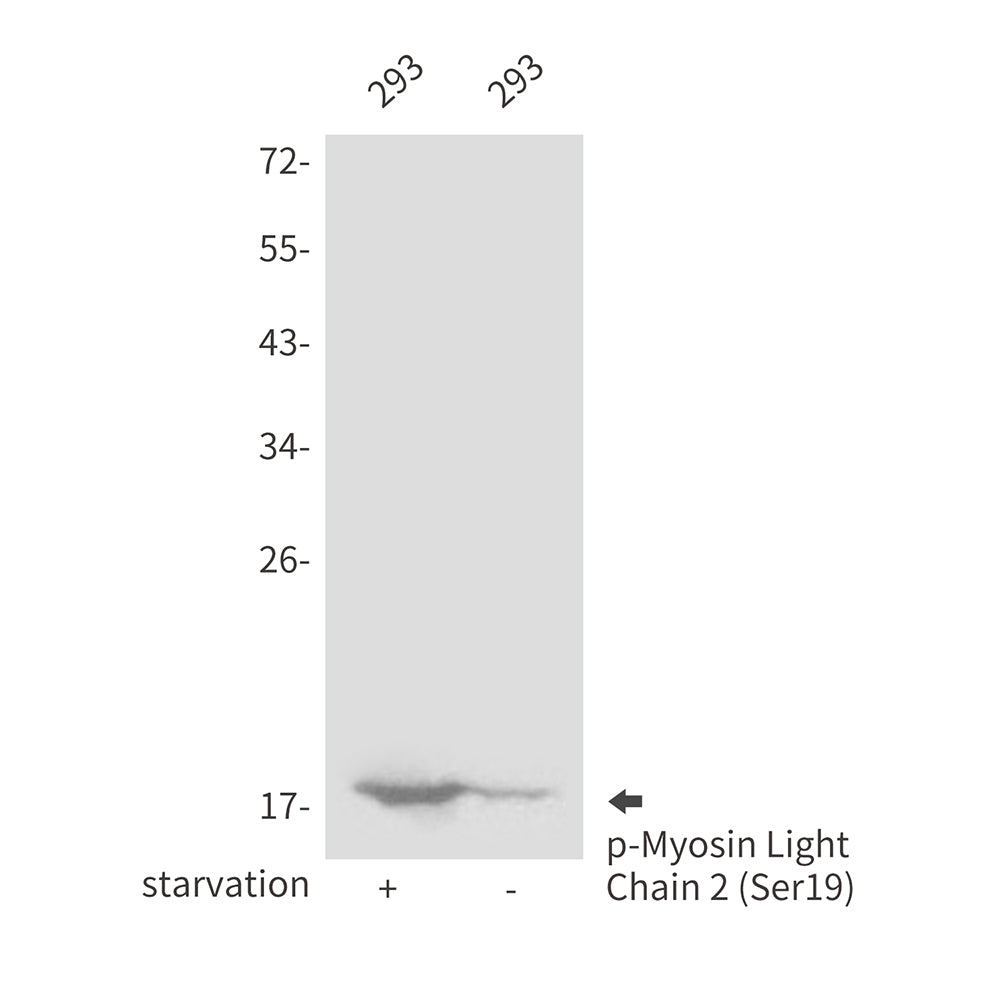 Anti-Phospho-Myosin Light Chain 2 (Ser19) Rabbit Polyclonal Antibody