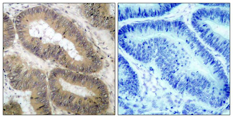Anti-Phospho-IKK alpha (Thr23) Rabbit Polyclonal Antibody